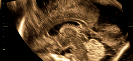 Imagen Estada de Perfeccionamiento en Neurosonografía Fetal