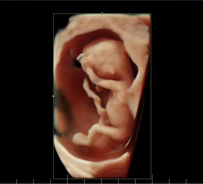 Imagen Curso Medicina Fetal Y Perinatal para Becados de Neonatología